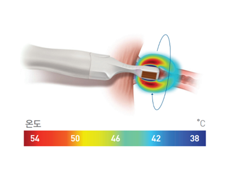 비비브2.0의 특징