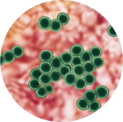 트리코모나스 질염