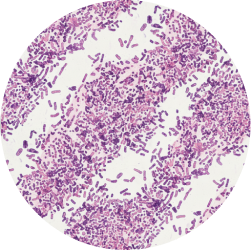 트리코모나스 질염